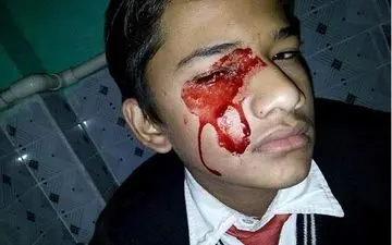 نوجوان ١٣ ساله ای که روزانه از گوش، چشم، شکم، ابروها و تار موهایش جوی خون راه می افتد! + عکس