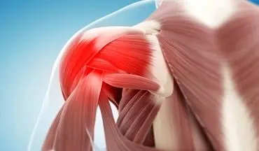 سندروم شانه یخ زده را حتما بررسی کنید!