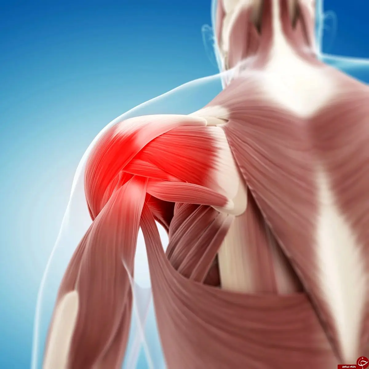 سندروم شانه یخ زده را حتما بررسی کنید!