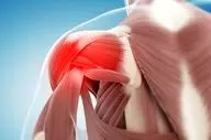 سندروم شانه یخ زده را حتما بررسی کنید!