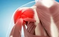 سندروم شانه یخ زده را حتما بررسی کنید!