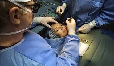 دلایل وفور جراحی‌های زیبایی در ایران