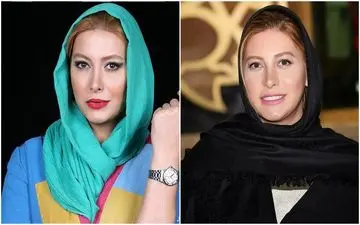 چهره باورنکردنی و زشت فریبا نادری قبل از عمل جراحی + عکس