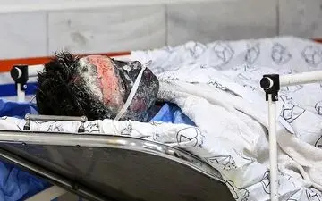 ۴۲۴ مصدوم و ۱۰ فوتی در حوادث چهارشنبه‌سوری/ ۹۰ درصد مصدومان مرد هستند 