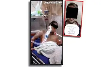 انتقام کورکورانه: اسیدپاشی به زنی به ظن خیانت