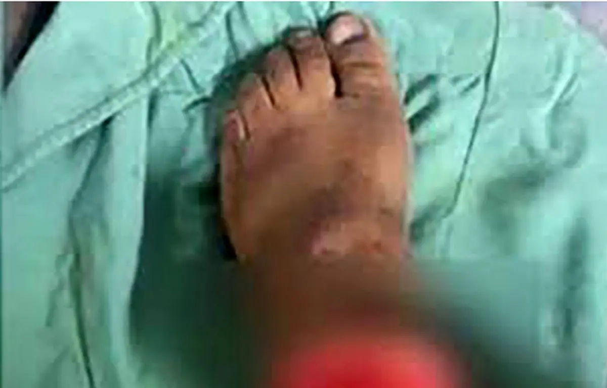 پای قطع شده زن جوان در کهریزک پیدا شد