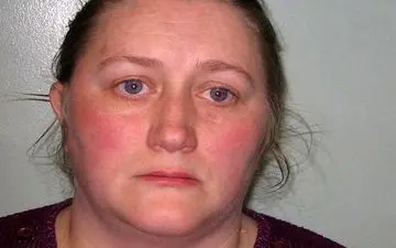 خانم پرستار وحشی زندانی شد + عکس 