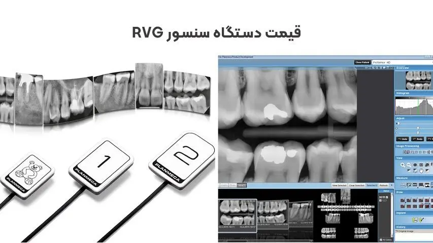 مزایای استفاده از سنسور RVG