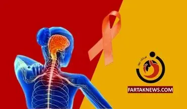 ابتلای ۱۲۰ هزار نفر به بیماری ام اس در کشور