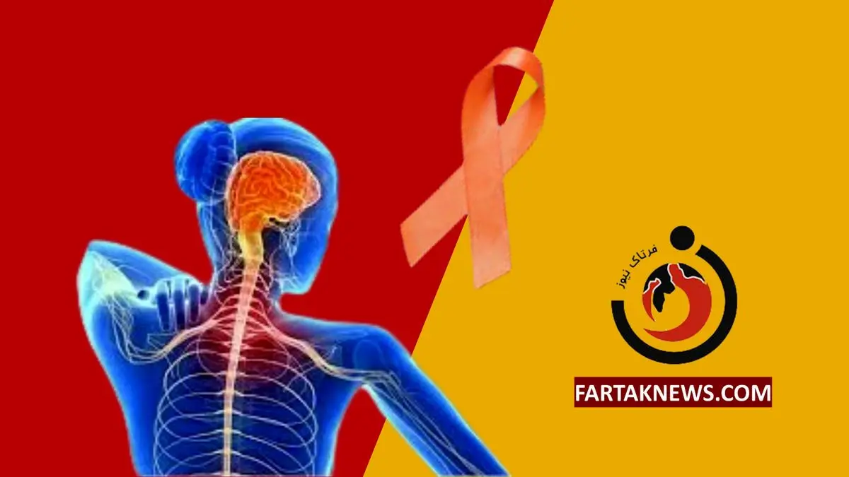   ابتلای ۱۲۰ هزار نفر به بیماری ام اس در کشور 