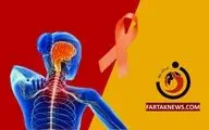ابتلای ۱۲۰ هزار نفر به بیماری ام اس در کشور