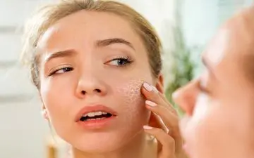 این گروه افراد بیشتر در معرض خطرخشکی پوست هستند