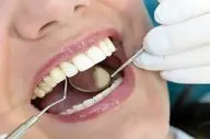 چه زمانی به متخصص ارتودنسی مراجعه کنیم؟