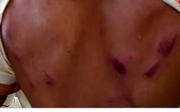 تنبیه بدنی شدید دانش آموز توسط معلم/جریان چه بود؟