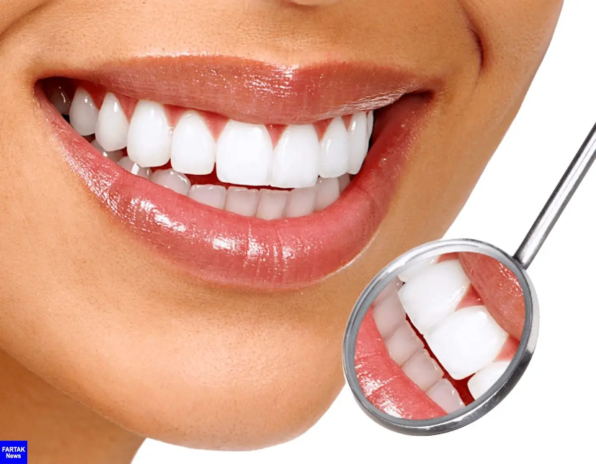 ارزانترین راهکارها برای زیبایی دندان