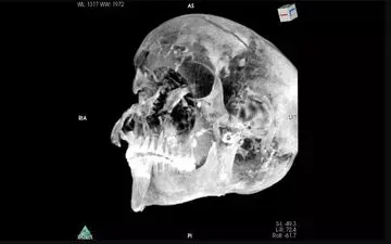 
کشف راز مرگ فرعون مصری
