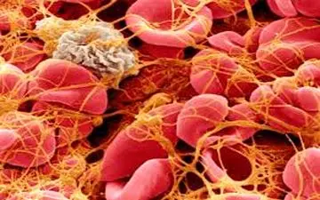 اگر مشکل پلاکت دارید این مطلب را از دست ندهید!