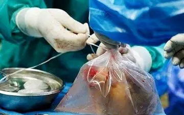 پرواز قلب زن تبریزی به تهران برای نجات