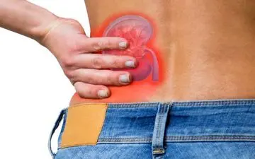 آیا سنگ کلیه باعث یبوست می شود ؟

