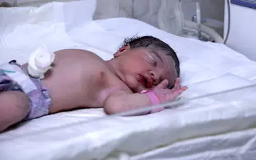 انجام دومین زایمان طبیعی بدون درد در کشور