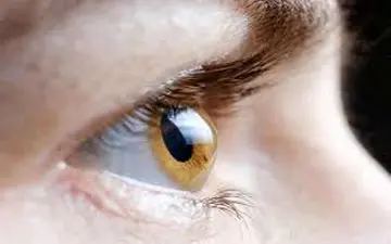  تشخیص به‌موقع و درمان قوز قرنیه!