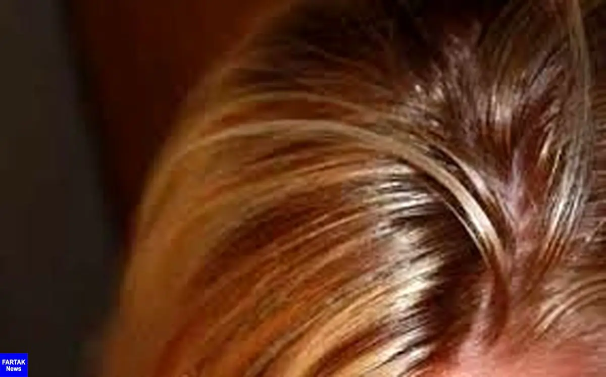 دلایل چرب شدن موی سر و راههای کاهش آن