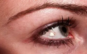 کوری دختران در لاکچری ترین عمل زیبایی 