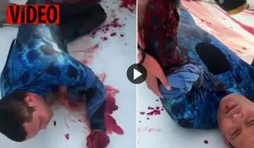 لحظه دلهره آور نجات غواص زخمی پس از حمله مرگبار کوسه