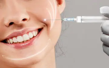 درمان خط خنده