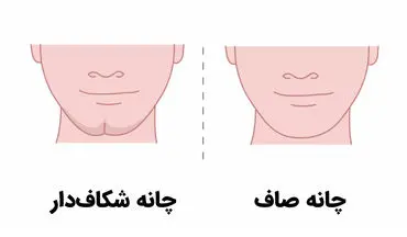 تست شخصیت؛ شاید باورتان نشود که شکل چانه می‌تواند حقایق درونیتان را فاش کند!
