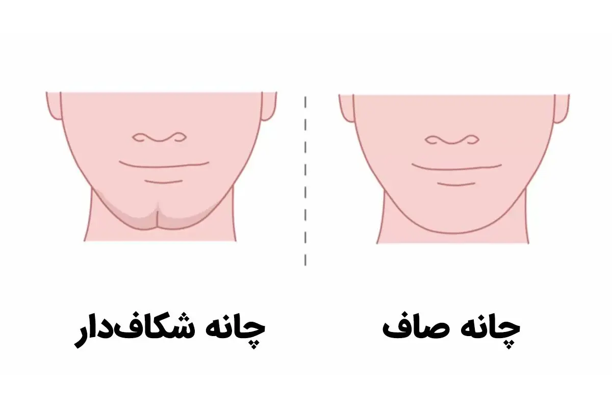 تست شخصیت؛ شاید باورتان نشود که شکل چانه می‌تواند حقایق درونیتان را فاش کند!
