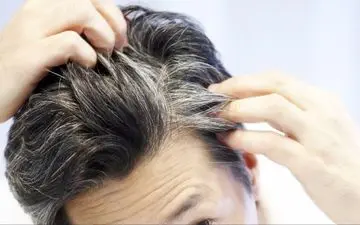 سفیدی مو زنگ خطری برای این بیماری‌