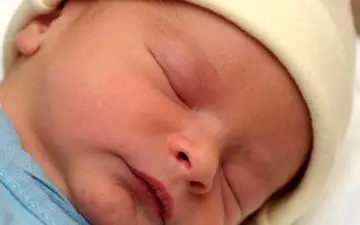 همه چیز درباره زردی در نوزادان

