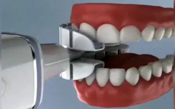 تاحالا زمان اشتباهی مسواک میزدی!بیا تا بهت بگم بهترین وقت برای مسواک زدن چه وقته!