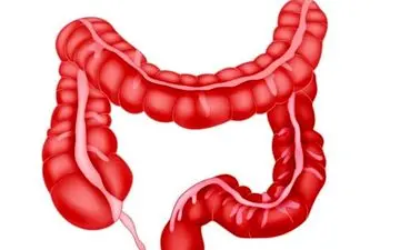 هیچ کس فکرش را هم نمیکند این نوع تغذیه برای روده مفید باشد!