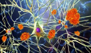 مصرف تخم مرغ باعث عدم ابتلا به آلزایمر می‌شود؟