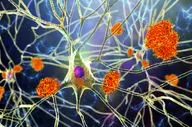 مصرف تخم مرغ باعث عدم ابتلا به آلزایمر می‌شود؟