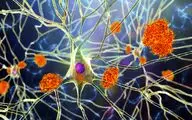 مصرف تخم مرغ باعث عدم ابتلا به آلزایمر می‌شود؟