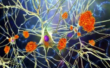 مصرف تخم مرغ باعث عدم ابتلا به آلزایمر می‌شود؟