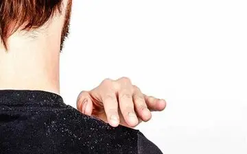 بهترین راه درمان شوره سربا طب سنتی