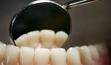 این علامت را نادیده نگیرید! رابطه عجیب سرعت افتادن دندان‌ها با مرگ زودرس