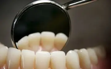 این علامت را نادیده نگیرید! رابطه عجیب سرعت افتادن دندان‌ها با مرگ زودرس