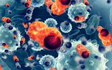 علت ابتلا به متاستاز مغزی چیست