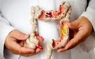 برای خلاصی از  یبوست  این خوراکی ها را بخورید!