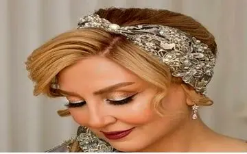 بازیگران زنی که بعد از عمل زیبایی دیگر قابل شناسایی نیستند! |این بازیگران با عمل زیبایی ۱۸۰ درجه عوض شدند!
