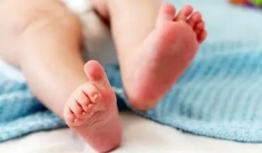 روش جلوگیری از نرمی استخوان+ اینفوگرافی