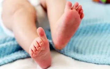 روش جلوگیری از نرمی استخوان+ اینفوگرافی