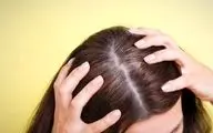 ۷ حقیقت شوکه‌کننده درباره موهای سفید که نمی‌دانستید!