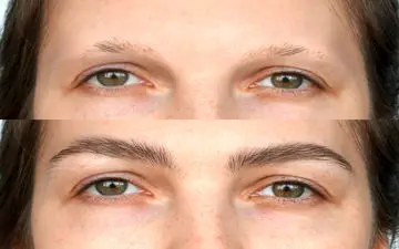 چرا کاشت ابرو در برخی موارد ماندگار نیست؟ نکاتی که باید قبل از انجام بدانید
