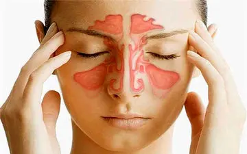 بایدها و نبایدها برای کسانی که سینوزیت دارند
